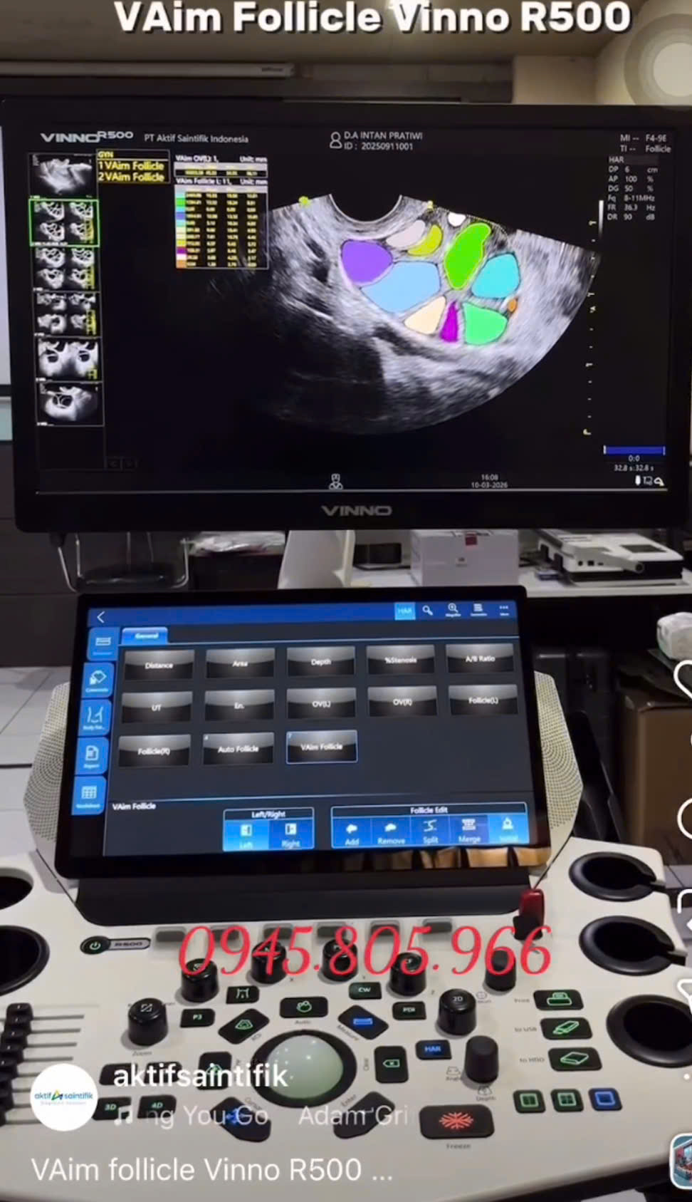 Máy siêu âm 5D Vinno R500